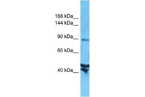 Host:  Rabbit  Target Name:  AXIN2  Sample Type:  Jurkat Whole Cell lysates  Antibody Dilution:  1. (AXIN2 anticorps  (N-Term))