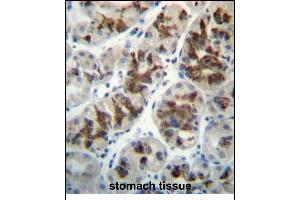 CTGF Antibody (Center) (ABIN657322 and ABIN2846396) immunohistochemistry analysis in formalin fixed and paraffin embedded human stomach tissue followed by peroxidase conjugation of the secondary antibody and DAB staining.