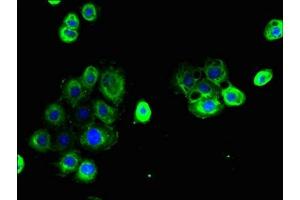 Immunofluorescent analysis of A431 cells using ABIN7147867 at dilution of 1:100 and Alexa Fluor 488-congugated AffiniPure Goat Anti-Rabbit IgG(H+L)