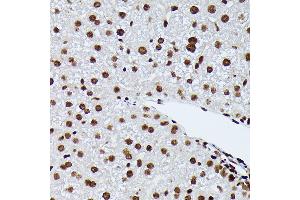 Immunohistochemistry of paraffin-embedded mouse liver using Phospho-NRF2-S40 Rabbit mAb (ABIN7268970) at dilution of 1:100 (40x lens).