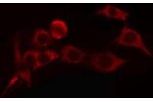 ABIN6275813 staining COLO205 cells by IF/ICC. (Cytochrome P450 4A11/22 anticorps)