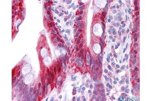 Immunohistochemistry (IHC) image for anti-Non-Metastatic Cells 1, Protein (NM23A) Expressed in (NME1) (N-Term) antibody (ABIN2792090)