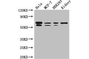 Western Blot Positive WB detected in: Hela whole cell lysate, MCF-7 whole cell lysate, HEK293 whole cell lysate, Mouse kidney tissue All lanes: RBPJ antibody at 3. (RBPJ anticorps  (AA 243-485))