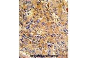 Immunohistochemistry (IHC) image for anti-Cyclin A2 (CCNA2) antibody (ABIN3003117) (Cyclin A anticorps)