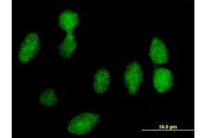 Immunofluorescence of purified MaxPab antibody to RPLP0 on HeLa cell. (RPLP0 anticorps  (AA 1-317))