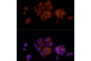 Immunofluorescence analysis of HepG2 cells using PAH Rabbit mAb (ABIN7269264) at dilution of 1:25 (40x lens). (Phenylalanine Hydroxylase anticorps)