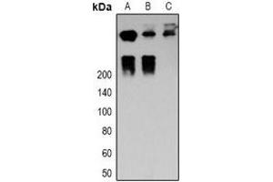 Western blot analysis of Desmoplakin expression in MCF7 (A), Hela (B), mouse heart (C) whole cell lysates.