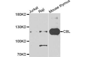 Western blot analysis of extracts of various cell lines, using CBL antibody (ABIN5995395) at 1/1000 dilution. (CBL anticorps)