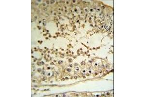 PE Antibody (C-term) (R) IHC analysis in forlin fixed and paraffin embedded hun testis tissue followed by peroxidase conjugation of the secondary antibody and DAB staining. (PRAME anticorps  (C-Term))