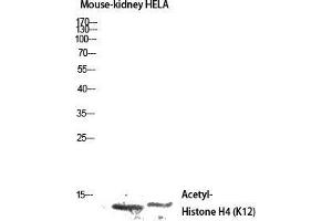 Western Blot (WB) analysis of Mouse Kidney HeLa lysis using Acetyl-Histone H4 (K12) antibody. (Histone H4 anticorps  (acLys12))