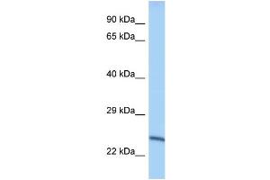 WB Suggested Anti-Mettl10 Antibody Titration: 1. (METTL10 anticorps  (Middle Region))
