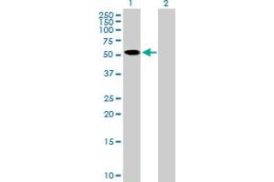 Western Blot analysis of ZNF410 expression in transfected 293T cell line by ZNF410 MaxPab polyclonal antibody. (ZNF410 anticorps  (AA 1-478))
