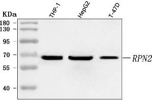 Western blot analysis of RPN2 using anti-RPN2 antibody (ABIN7602211).
