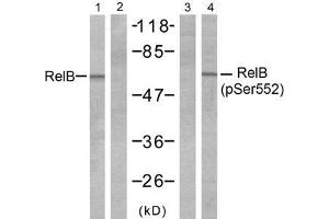 Western blot analysis of extracts from A431 cells, untreated or treated with EGF (200ng/ml 10min), using RelB (Ab-552) antibody (E021247, Line 1 and 2) and RelB (phospho- Ser552) antibody (E011255, Line 3 and 4). (RELB anticorps  (pSer552))