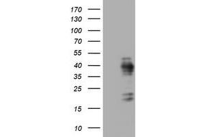 Image no. 1 for anti-Antigen Identified By Monoclonal Antibody Ki-67 (MKI67) (AA 1160-1493) antibody (ABIN1490860) (Ki-67 anticorps  (AA 1160-1493))