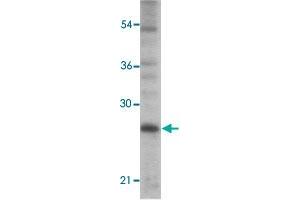 Western blot analysis of PC-3 cells with TICAM2 polyclonal antibody  at 1 ug/mL dilution. (TICAM2 anticorps  (C-Term))