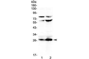 Western blot testing of rat 1) RH35 and 2) PC-12 cell lysate with Factor D antibody at 0.