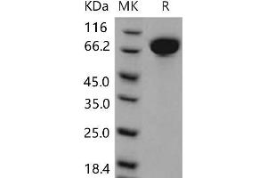 Western Blotting (WB) image for Mast/stem Cell Growth Factor Receptor (KIT) (Active) protein (His tag) (ABIN7320245)