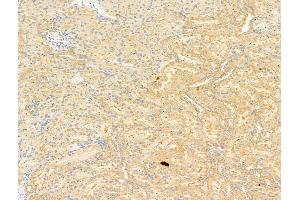 ABIN6263730 and ABIN6266924 at 1/100 staining Rat kidney tissue by IHC-P. (NRF2 anticorps  (N-Term))