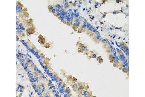 Immunohistochemistry of paraffin-embedded Mouse lung using IL36G Polyclonal Antibody at dilution of 1:100 (40x lens). (IL1F9 anticorps)