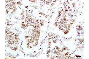 Formalin-fixed and paraffin embedded rat intestine tissue labeled with Anti OTC Polyclonal Antibody, Unconjugated (ABIN720505) at 1:200 followed by conjugation to the secondary antibody and DAB staining (OTC anticorps  (AA 51-150))