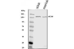 Western blot analysis of HCN4 using anti-HCN4 antibody (ABIN7602652).