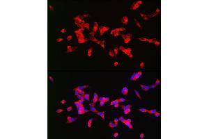 Immunofluorescence analysis of SH-SY5Y cells using CHRM1 Rabbit pAb (ABIN3022210, ABIN3022211, ABIN3022212, ABIN1512760 and ABIN6218670) at dilution of 1:200 (40x lens). (CHRM1 anticorps  (C-Term))
