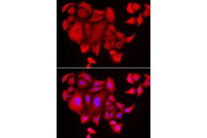 Immunofluorescence analysis of HeLa cell using SLC26A2 antibody. (SLC26A2 anticorps)