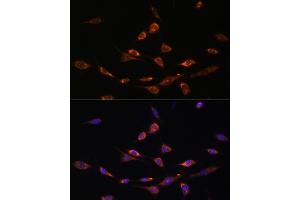 Immunofluorescence analysis of NIH-3T3 cells using P antibody (ABIN7269162) at dilution of 1:100.