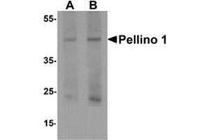 Western blot analysis of Pellino 1 in human liver tissue lysate with Pellino 1 Antibody  at (A) 1 and (B) 2 μg/ml. (Pellino 1 anticorps  (C-Term))