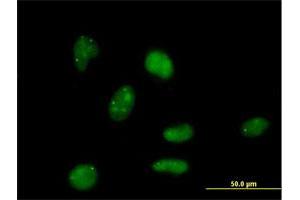 Immunofluorescence of purified MaxPab antibody to E4F1 on HeLa cell. (E4F1 anticorps  (AA 1-784))