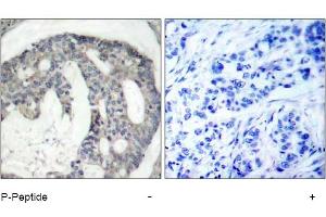 Image no. 1 for anti-Nitric Oxide Synthase 3 (Endothelial Cell) (NOS3) (pSer1177) antibody (ABIN319231) (ENOS anticorps  (pSer1177))