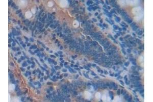 Detection of NOX1 in Rat Small intestine Tissue using Polyclonal Antibody to Nicotinamide Adenine Dinucleotide Phosphate Oxidase 1 (NOX1) (NOX1 anticorps  (AA 291-544))