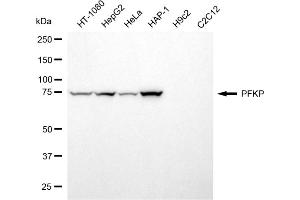 Western blotting analysis using PFKP antibody (ABIN7799802). (PFKP anticorps)