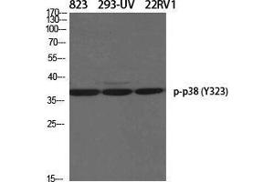 Western Blot (WB) analysis of specific cells using Phospho-p38 (Y323) Polyclonal Antibody. (MAPK14 anticorps  (pTyr323))