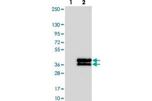 Western blot analysis of Lane 1: Negative control (vector only transfected HEK293T lysate). (KIF25 anticorps)