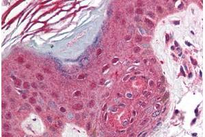 Human Skin (formalin-fixed, paraffin-embedded) stained with PDCD1 antibody ABIN214464 at 2. (PD-1 anticorps  (C-Term))