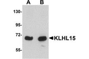 Western Blotting (WB) image for anti-Kelch-Like 15 (KLHL15) (C-Term) antibody (ABIN1030470) (KLHL15 anticorps  (C-Term))