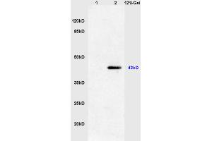 Lane 1: mouse heart lysates Lane 2: mouse S/P20 cell lysates probed with Anti phospho-ERK1(Thr202/Tyr204) +ERK2(Thr183/Tyr185) Polyclonal Antibody, Unconjugated (ABIN732458) at 1:200 in 4 °C. (ERK1/2 anticorps  (pThr183, pTyr185))