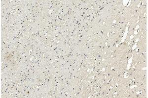 Immunohistochemical analysis of paraffin-embedded Human brain section using Pink1 am7099a.