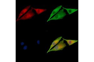 ABIN7095045 and ABIN7099101 staining  cells by IF/ICC.