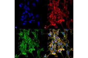 Immunocytochemistry/Immunofluorescence analysis using Mouse Anti-Citrulline Monoclonal Antibody, Clone 6C2. (Citrulline anticorps  (PE))