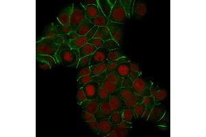 Confocal Immunofluorescence of MCF-7 cells E-Cadherin Mouse Monoclonal Antibody (CDH1/1525). (E-cadherin anticorps)