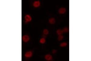 anti-Myeloid Zinc Finger 1 (MZF1) (N-Term) antibody