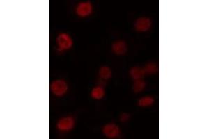 ABIN6274221 staining 293 cells by IF/ICC. (MZF1 anticorps  (N-Term))