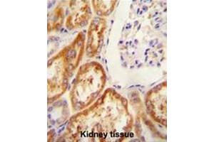 CLDN16 antibody (N-term) immunohistochemistry analysis in formalin fixed and paraffin embedded human Kidney tissue followed by peroxidase conjugation of the secondary antibody and DAB staining. (Claudin 16 anticorps  (N-Term))