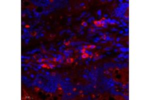 Immunofluorescence of paraffin embedded rat small intestine using ARHGAP18 (ABIN7075417) at dilution of 1: 700 (450x lens) (ARHGAP18 anticorps)