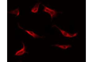 ABIN6269245 staining Hela by IF/ICC. (STAT1 anticorps)