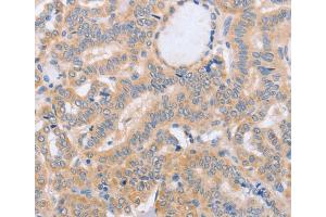 Immunohistochemistry (IHC) image for anti-Bone Marrow Stromal Cell Antigen 1 (BST1) antibody (ABIN2432738) (BST1 anticorps)