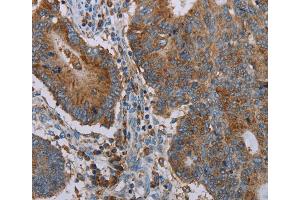 Immunohistochemistry (IHC) image for anti-Cytochrome P450, Family 7, Subfamily A, Polypeptide 1 (CYP7A1) antibody (ABIN2435000)